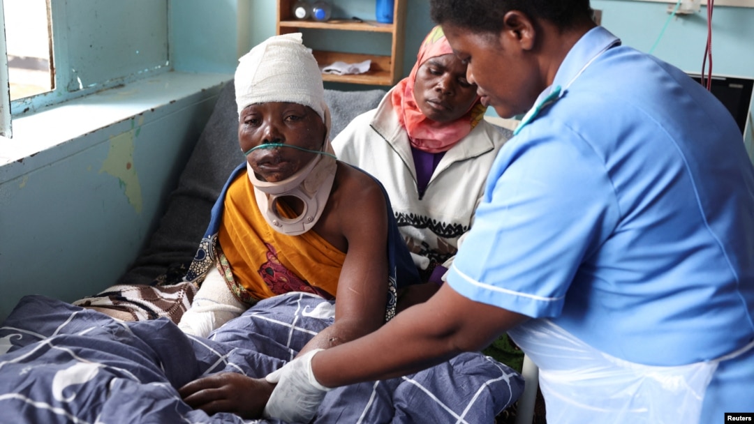 FILE — A nurse treats a flood victim in Queen Elizabeth Central hospital in Blantyre, Malawi, March 16, 2023. In Malawi, thousands of unemployed nurses are urging the government to help them find work.
