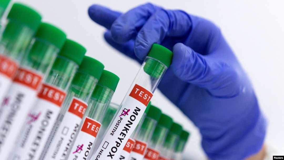 El gobierno venezolano informó que se dará seguimiento a viajeros de países con brotes confirmados, quienes deberán reportar su estado de salud y datos personales al ingresar al país para posible seguimiento médico.