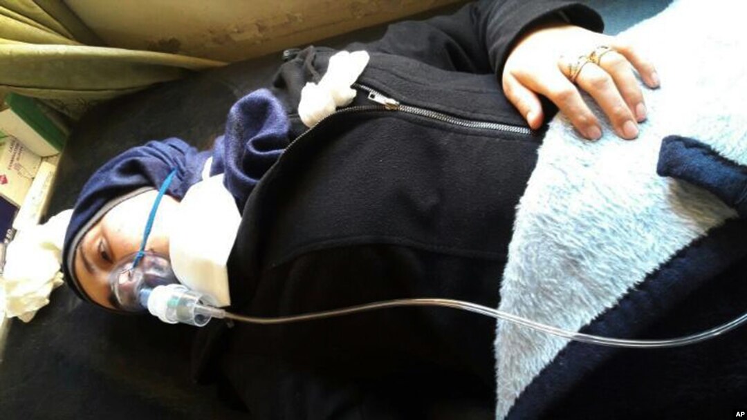 Aja Fadl leži na krevetu sa maskom za kiseonik na licu, koja joj pomaže da diše, nakon mogućeg hemijskog napada na njen grad Kan Šeikun u severnoj provinciji Idlib, Sirija, 5. aprila 2017. (Courtesy of Aya Fadl via AP)