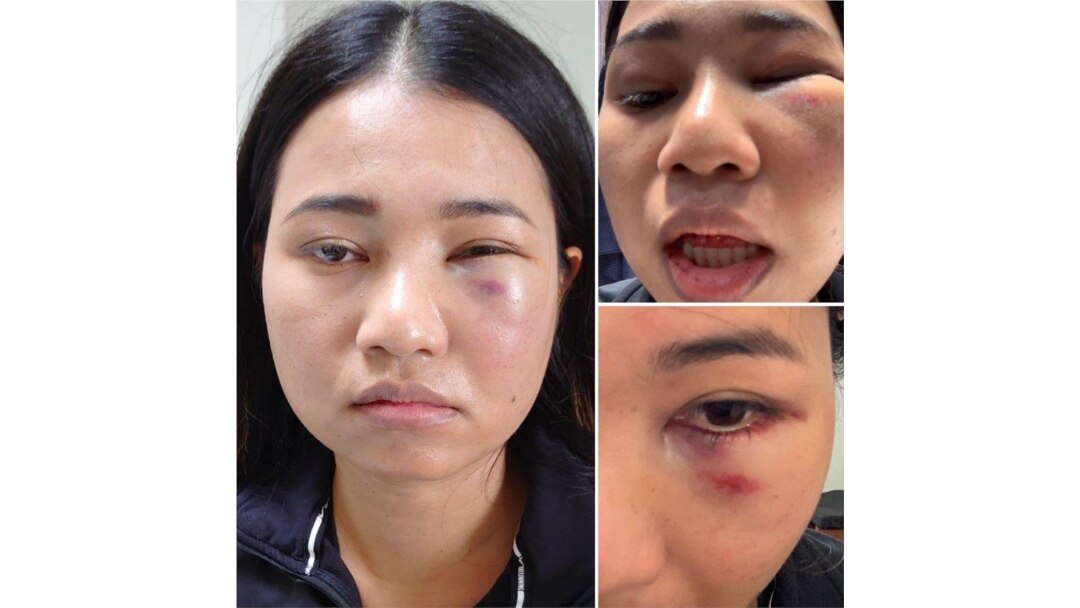 Mantakarn, a Thai-American woman who was assaulted while riding the BART train in San Francisco, CA. (Credit: Dion Lim)