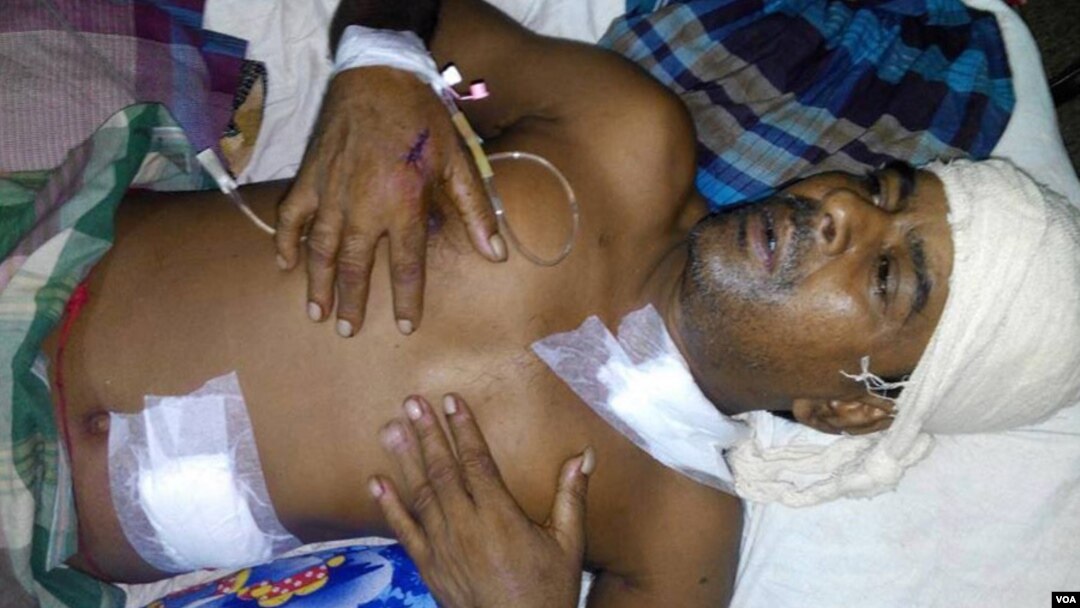 Chittaranjan Arya, a Hindu priest of a temple of goddess Kali in Meherpara village of Narsingdi district, Bangladesh, lies on bed after being hacked by unidentified assailants, Aug. 23, 2016. (P. Chandra/VOA)