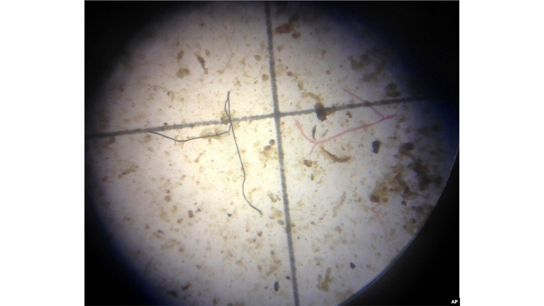 FILE - A possible plastic microfiber, left, is shown through a microscope during an examination of nearby ocean water in Key Largo, Florida, Feb. 7, 2017.